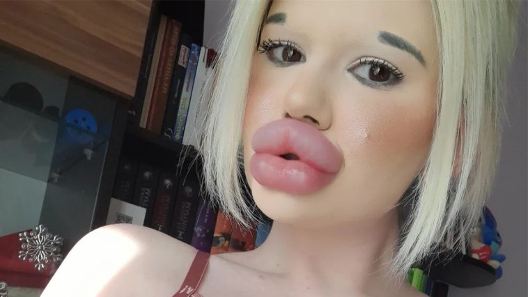 Andrea twierdzi, że ma największe usta na świecie - fot. Instagram @andrea88476