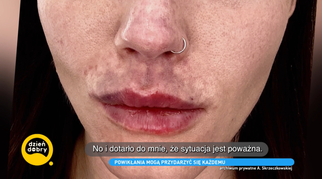 Agnieszka Skrzeczkowska -fot. screenshot dziendobry.tvn.pl